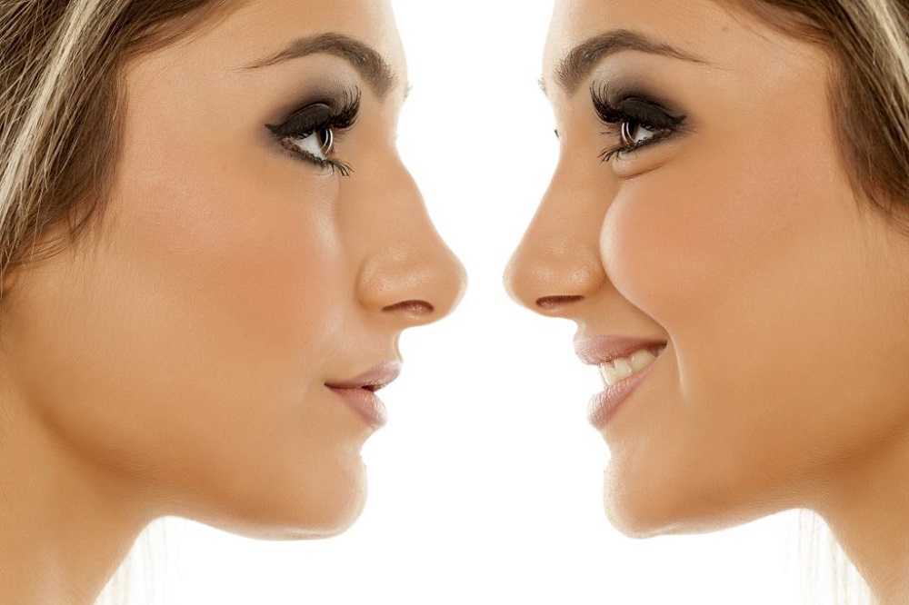 Nose Surgery Techniques: Here’s Everything You Need To Know